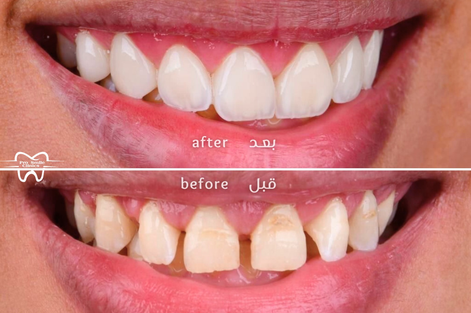 before after 3